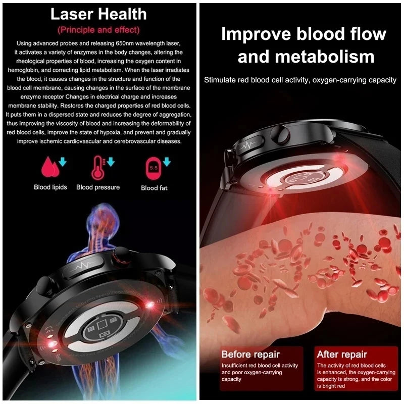 2025 New Non-Invasive Laser Treatment Three High Smart Watch Sapphire screen Blood fat Uric Acid ECG Health Diagnosis